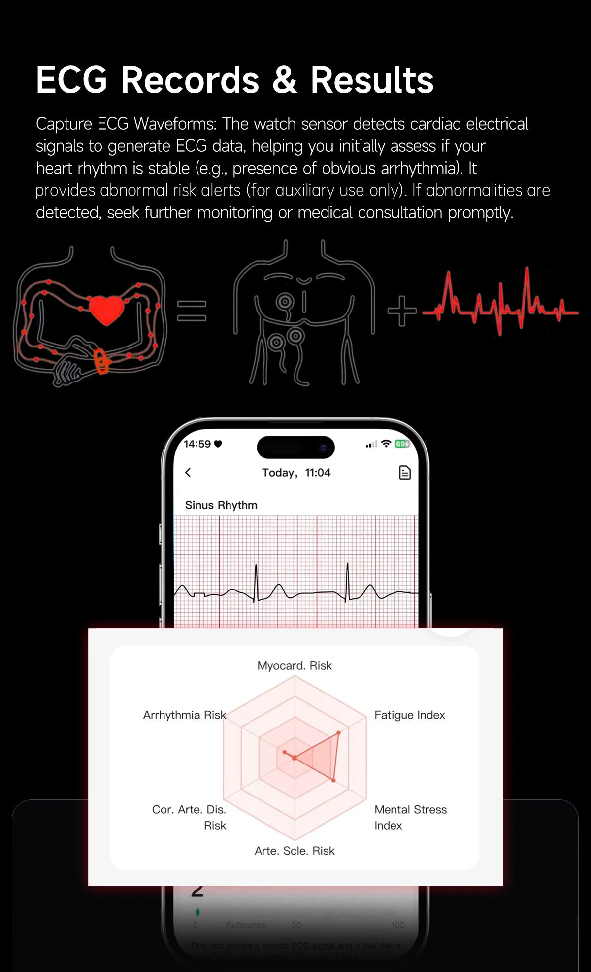 LIGE ECG Smart Watch for Men  Women Sports Fitness Temperature Health Monitoring Waterproof Wristbands No Screen Smart Bracelet